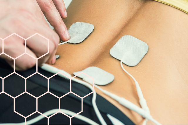 TENS in Labour: A Drug-Free Option for Pain Relief